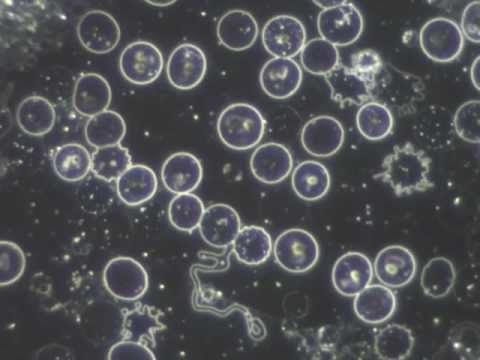 Microscop a